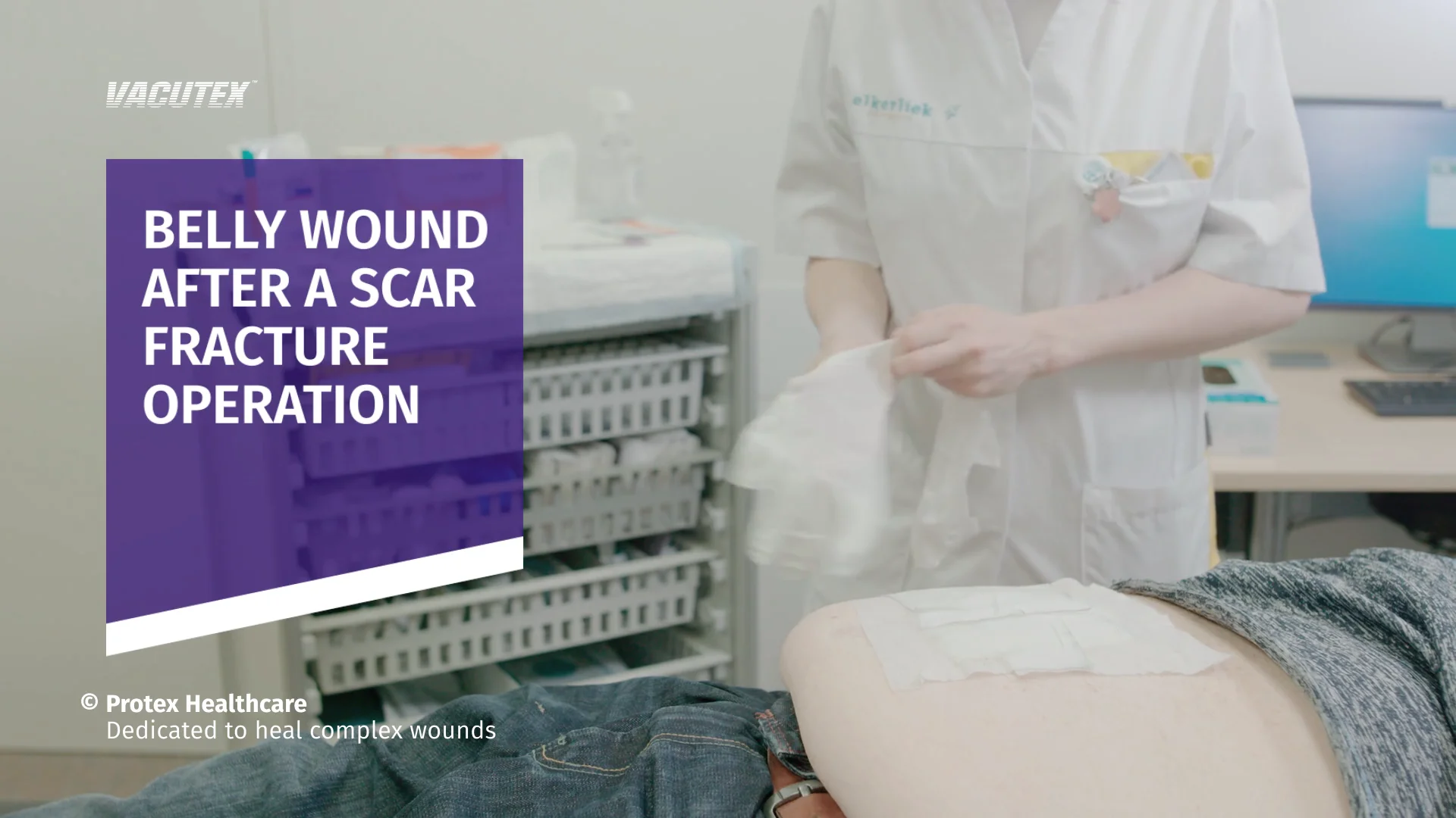 Nurse changing the dressing on a patient's abdominal wound